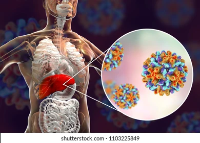What is Hepatitis B? 21 hepatitis B