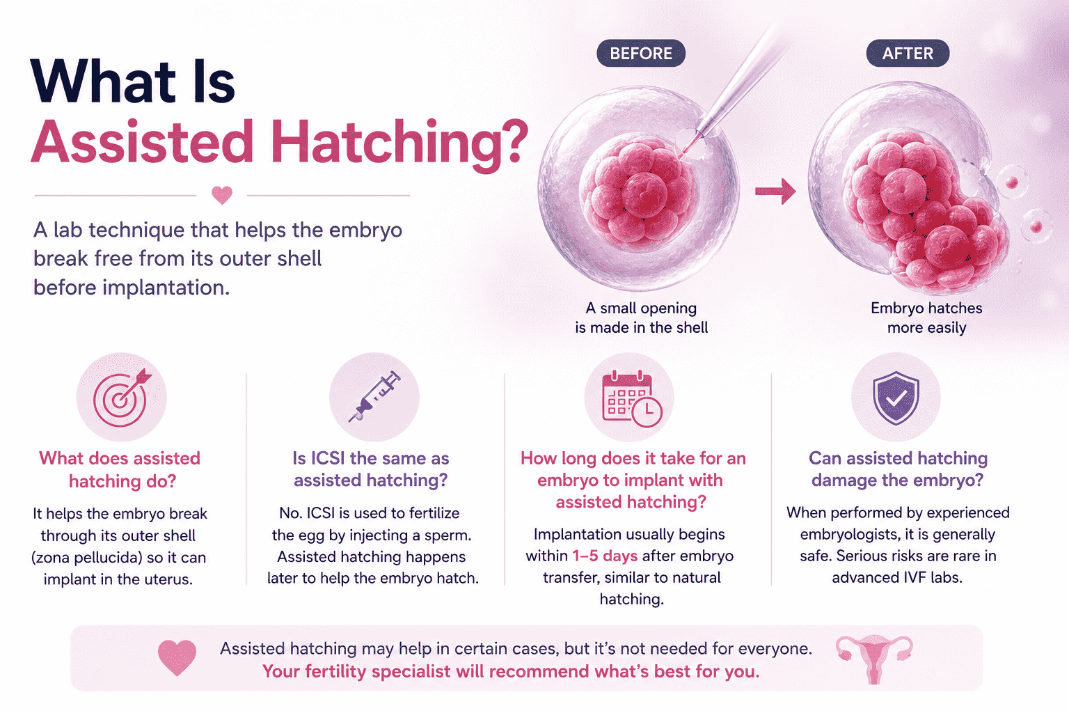 What Is Assisted Hatching? Understanding How This IVF Technique May Improve Implantation 2 assisted hatching